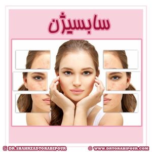 سابسیژن - دکتر شهرزاد ترابی پور
